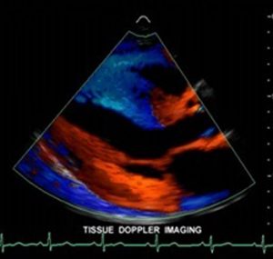 Cardiac Sonograph